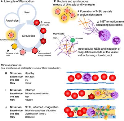 Neutrophil Extracellular Traps Open the Pandora’s Box in Severe Malaria